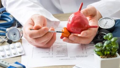 علاج البروستاتا. أعشاب طبيعية مجربة-التشافي بالغذاء