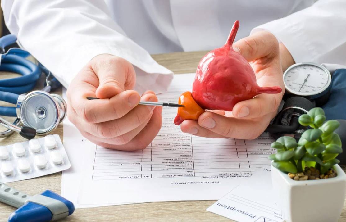 علاج البروستاتا. أعشاب طبيعية مجربة-التشافي بالغذاء