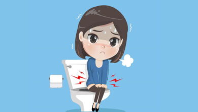 صينية تحتوي على ثمار التين المجفف-التشافي بالغذاء