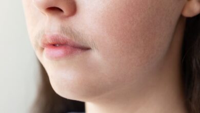 فتاة تشتكي من ظهور الشعر في الشفه العلوي من فمها-التشافي بالغذاء