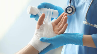 كيف تعالج الحروق بطرق منزلية سهلة؟-التشافي بالغذاء