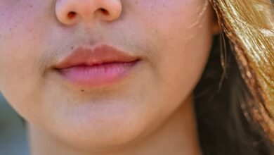 أسباب وأعراض الشعرانية عند النساء-التشافي بالغذاء