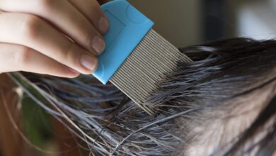 8 علاجات منزلية فعالة للتخلص من القمل-التشافي بالغذاء