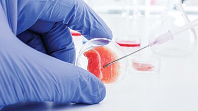 العلاج بالخلايا الجذعية هل يفيد حقاً للتصلب المتعدد؟-التشافي بالغذاء