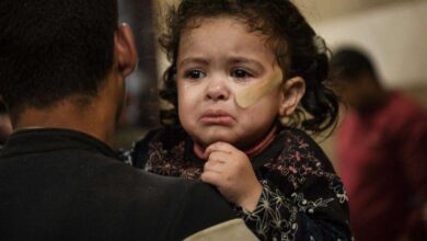 أب يحمل طفلته المصابة في غزة جراء الحرب هناك-التشافي بالغذاء